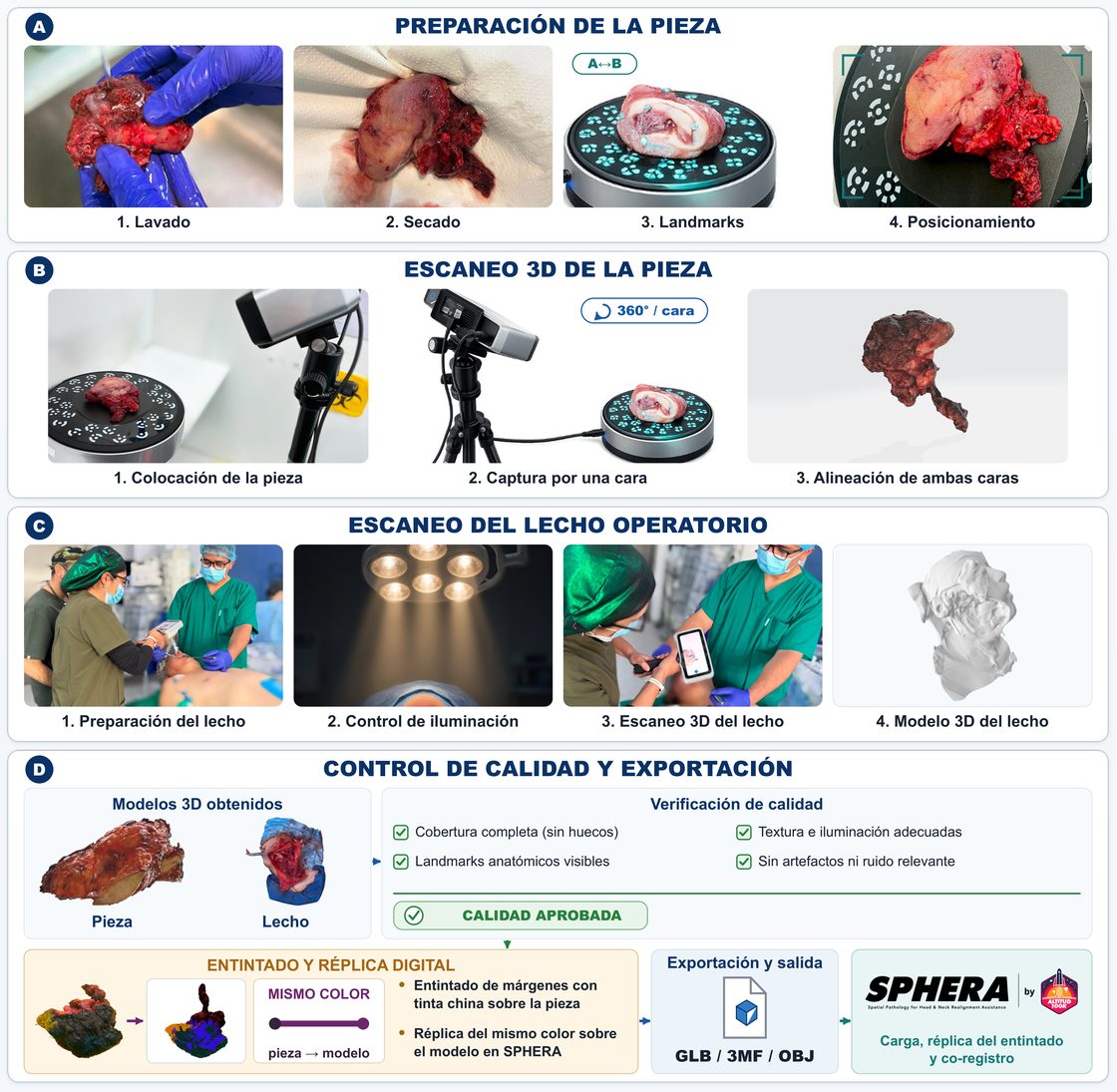 Protocolo de escaneo en cuatro bloques: preparación de la pieza con lavado, secado, colocación de landmarks y posicionamiento; escaneo 3D de la pieza por ambas caras; escaneo del lecho operatorio con control de iluminación; y control de calidad y exportación, con el entintado de márgenes replicado en el mismo color sobre el modelo digital antes de cargarlo en SPHERA.